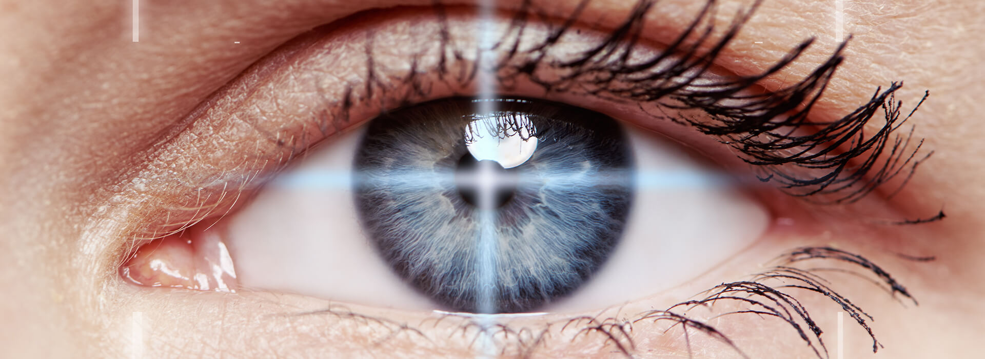 understanding prk laser eye surgery