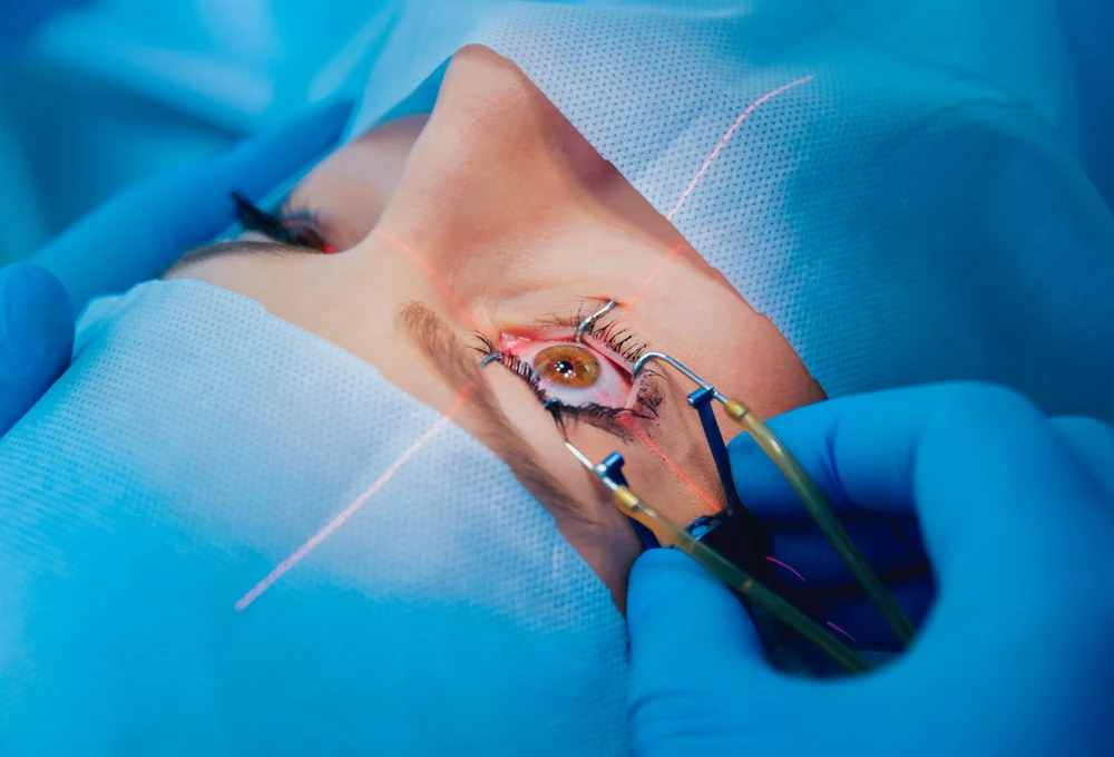 8-second smile pro laser eye surgery for calgary's climate